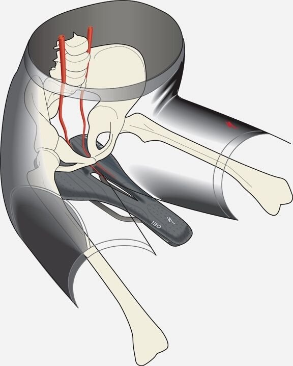 The Pelvic Bone